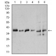 Western blot analysis using ANXA1 antibody against human ANXA1 recombinant protein. (Expected MW is 33.7 kDa).