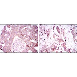 Ataxin 1 (ATXN1) Antibody