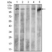 Western blot analysis using ACLY antibody against human ACLY recombinant protein. (Expected MW is 46.7 kDa).