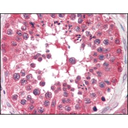 Serine/threonine-Protein Kinase B-Raf (BRAF) Antibody