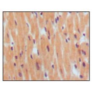 Immunohistochemical analysis of paraffin-embedded human normal myocardium, showing cytoplasmic localization using BNP1 antibody with DAB staining.
