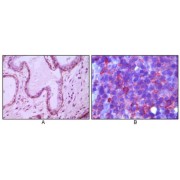 Immunohistochemical analysis of paraffin-embedded human breast ductal myoepithelium (A) and lymph tissue (B), showing cytoplasmic (A) and membrane (B) localization using CD10 antibody with DAB staining (A) and AEC staining (B).