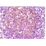 abx010514