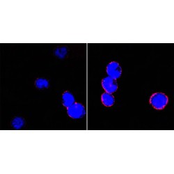 Integrin Beta 2 (ITGB2) Antibody
