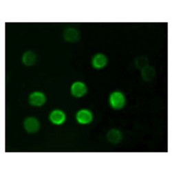 B-Lymphocyte Antigen CD20 (MS4A1) Antibody