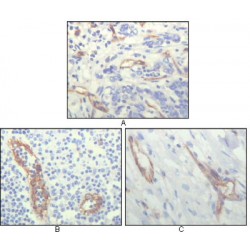 Platelet And Endothelial Cell Adhesion Molecule 1 (PECAM1) Antibody