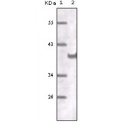 Western blot analysis using CD31 antibody against truncated CD31 recombinant protein.