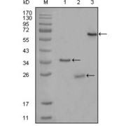 abx010522