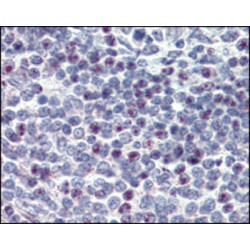 Hematopoietic Progenitor Cell Antigen CD34 (CD34) Antibody