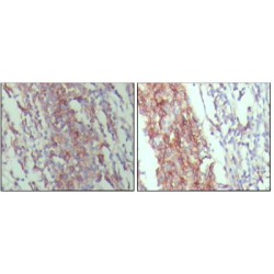 Receptor-Type Tyrosine-Protein Phosphatase C / CD45 (PTPRC) Antibody