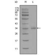 Western blot analysis using anti-CD45 monoclonal antibody against truncated CD45 recombinant protein (1).