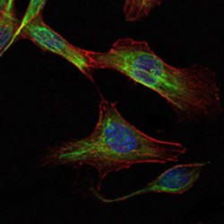 Rapamycin-Insensitive Companion of mTOR (RICTOR) Antibody