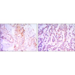 Rapamycin-Insensitive Companion of mTOR (RICTOR) Antibody
