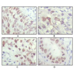 Serine/threonine-Protein Kinase Chk2 (CHK2) Antibody