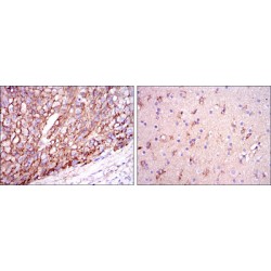 Apolipoprotein E (ApoE) Antibody