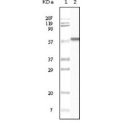 Western blot analysis using CK1 antibody against truncated CK1 recombinant protein.