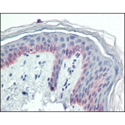 Cytokeratin 5 (CK-5) Antibody
