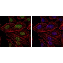 Polycomb Complex Protein BMI-1 (BMI1) Antibody