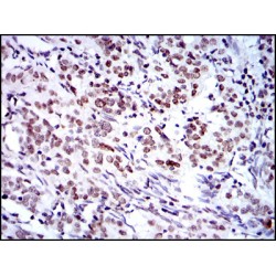 Polycomb Complex Protein BMI-1 (BMI1) Antibody