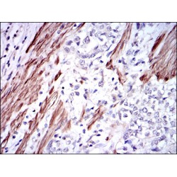 Glutathione S Transferase Mu 1 (GSTM1) Antibody