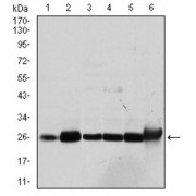 Western blot analysis using GSTM1 antibody against human GSTM1 (AA: 23-181) recombinant protein. (Expected MW is 25.7 kDa).
