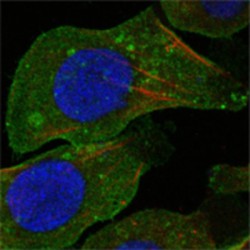 Discoidin Domain Receptor Tyrosine Kinase 2 (DDR2) Antibody