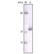 Western blot analysis using DDR2 antibody against truncated DDR2 recombinant protein.