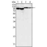 Western blot analysis using BTK antibody against K562 (1), MCF-7 (2), Jurkat (3) and HEK293 (4) cell lysate.
