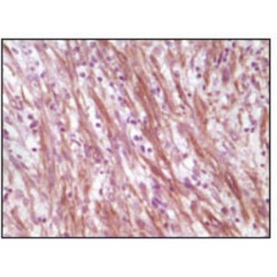 Desmin (DES) Antibody