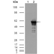 Western blot analysis using Desmin antibody against HEK293T cells transfected with the pCMV6-ENTRY control (1) and pCMV6-ENTRY Desmin cDNA (2).