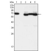 Western blot analysis using TCF3 antibody against A549 (1), A431 (2), Hela (3), PANC-1 (4) and PC-3 (5) cell lysate.