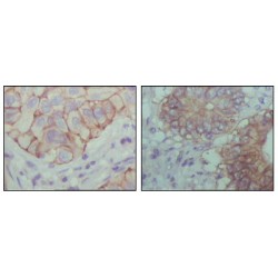 EhpB1 Antibody