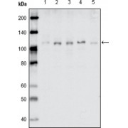 Western blot analysis using EhpB1 antibody against MDA-MB-468 (1), MDA-MB-453 (2), MCF-7 (3), T47D (4) and SKBR-3 (5) cell lysate.