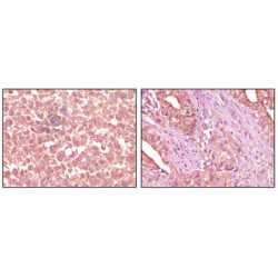 EPH Receptor A2 (EphA2) Antibody