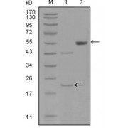 Western blot analysis using EPHA5 antibody against truncated EPHA5-His recombinant protein (1) and truncated EPHA5 (aa620-774) -hIgGFc transfected CHO-K1 cell lysate (2).