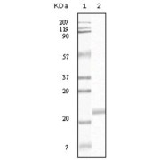 Western blot analysis using EphB4 antibody against truncated EphB4 recombinant protein.