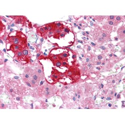 Ephrin Type B Receptor 3 (EphB3) Antibody
