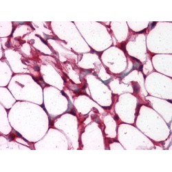 Protein C-Ets-1 (ETS1) Antibody