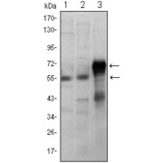 Western blot analysis using ETS1 antibody against Jurkat (1), HepG2 (2) and ETS1-hIgGFc transfected HEK293 (3) cell lysate.