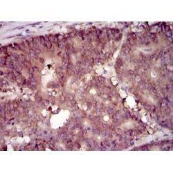 Eukaryotic Translation Initiation Factor 4B (EIF4B) Antibody