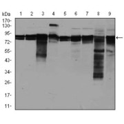 Western blot analysis using EIF4B antibody against human EIF4B (AA: 381-585) recombinant protein. (Expected MW is 48.3 kDa).