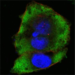 Tyrosine Protein Kinase Fer (FER) Antibody