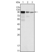 Western blot analysis using FER antibody against NIH/3T3 (1), A549 (2) and SK-MEL-5 (3) cell lysate.
