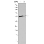 Western blot analysis using FGR antibody against HL60 (1) Raw264.7 (2) cell lysate.