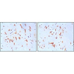 Fragile X Mental Retardation 1 (FMR1) Antibody