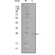 Western blot analysis using GATA3 antibody against truncated GATA3-His recombinant protein (1).