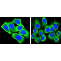 Glyceraldehyde-3-Phosphate Dehydrogenase (GAPDH) Antibody
