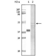 Western blot analysis using GSK3 alpha antibody against truncated GSK3 alpha recombinant protein (1) and A549 cell lysate (2).