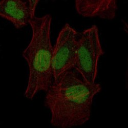 Dual Specificity Mitogen-Activated Protein Kinase Kinase 7 (MAP2K7) Antibody