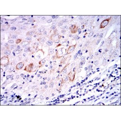 Dual Specificity Mitogen-Activated Protein Kinase Kinase 7 (MAP2K7) Antibody
